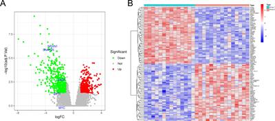 SNAP25-induced MYC upregulation promotes high-grade neuroendocrine lung carcinoma progression